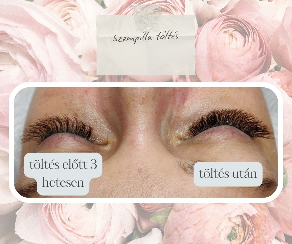 Szempillaépítés