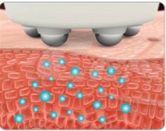 Hydra Touch H2 elektroporáció